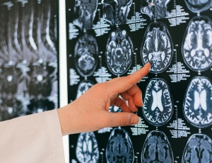 Brain implant turns thoughts into speech in near real-time