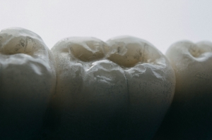 Teeth hurt? It could be because of a 500-million-year-old fish